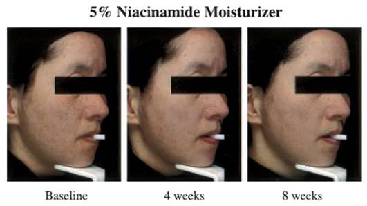 niacinamide_moisturizer-reserach