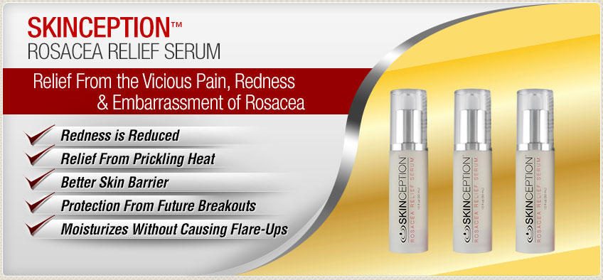 rosacea